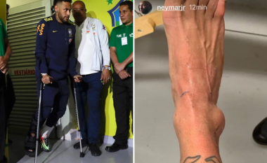 Neymar zbulon dëmtimin e tij të tmerrshëm në një postim në rrjetet sociale