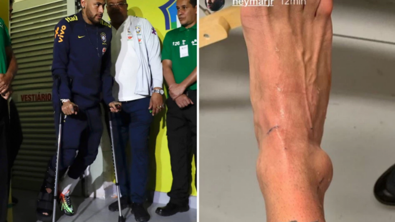 Neymar zbulon dëmtimin e tij të tmerrshëm në një postim në rrjetet sociale