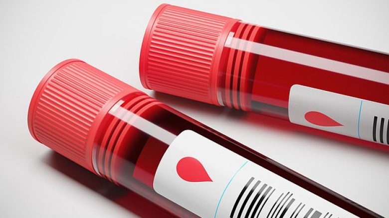 Shkencëtarët e kanë krijuar testin e gjakut që ju tregon a do të vdisni brenda 10 viteve