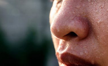 Djersitja e tepërt në fytyrë, çfarë është kjo sëmundje dhe si trajtohet