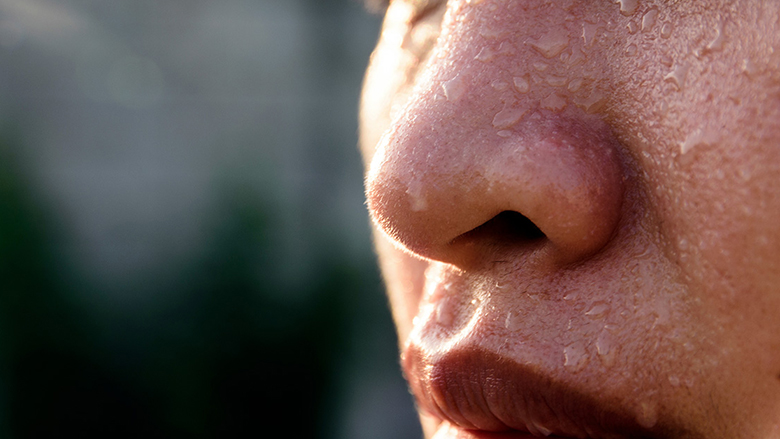 Djersitja e tepërt në fytyrë, çfarë është kjo sëmundje dhe si trajtohet