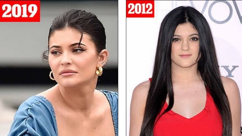 Pse Kylie Jenner duket një dekadë më e vjetër se sa është? – Evoluimi drastik i miliarderes më të re në botë në kaq pak kohë