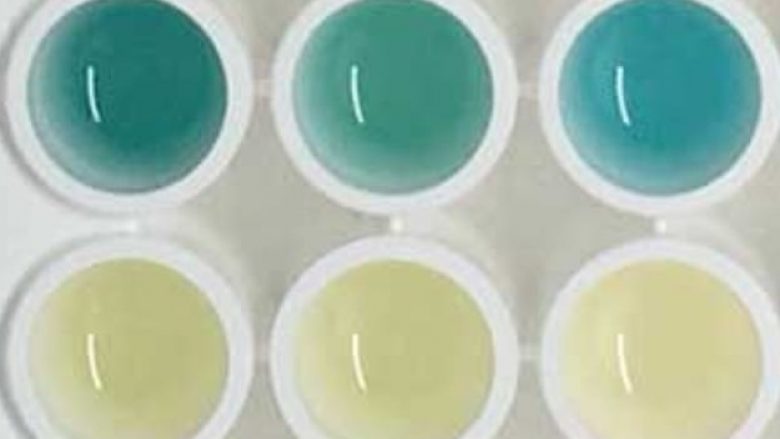 Shkencëtarët e kanë krijuar një test të urinës që i ndryshon ngjyra nëse keni kancer
