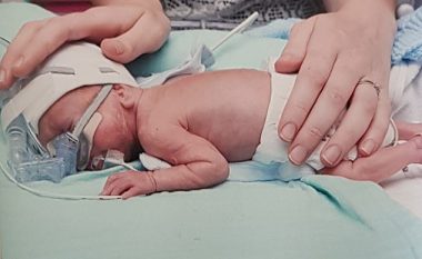 Lindi 16 javë para kohe me peshë vetëm 700 gramë, mjekët thanë se e ka të vështirë të mbijetojë – ai festoi ditëlindjen e parë me shëndet të plotë