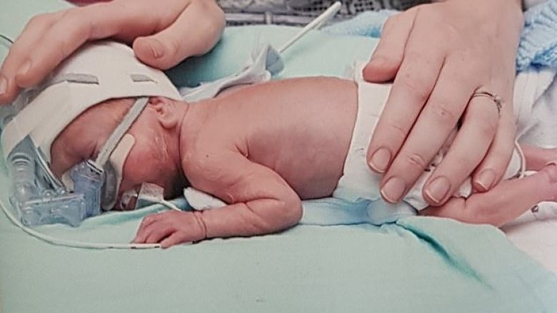 Lindi 16 javë para kohe me peshë vetëm 700 gramë, mjekët thanë se e ka të vështirë të mbijetojë – ai festoi ditëlindjen e parë me shëndet të plotë