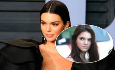 Ndryshimi i Kendall Jenner - tregon nëse ka bërë ndërhyrje kirurgjike