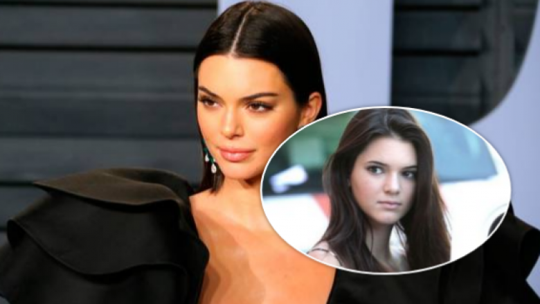 Ndryshimi i Kendall Jenner – tregon nëse ka bërë ndërhyrje kirurgjike