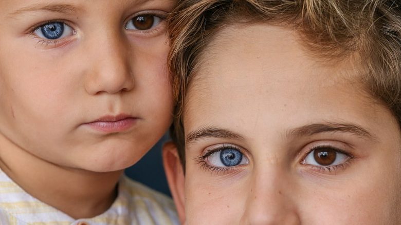 Vëllezërit turq befasojnë me ngjyrat e syve, shkaku i gjendjes së rrallë njërin sy e kanë të kaltër e tjetrin ngjyrëkafe