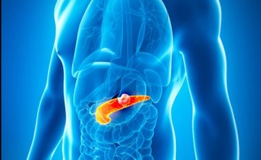Rastet e kancerit në zorrë dhe pankreas shënojnë rritje të madhe – shenjat që duhet t’i dini