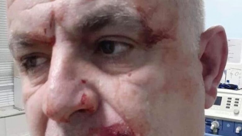 Dega e PDK-së në Ferizaj: Aktivistët e Vetëvendosjes kanë sulmuar veprimtarin e PDK-së, Jakup Sabedinin