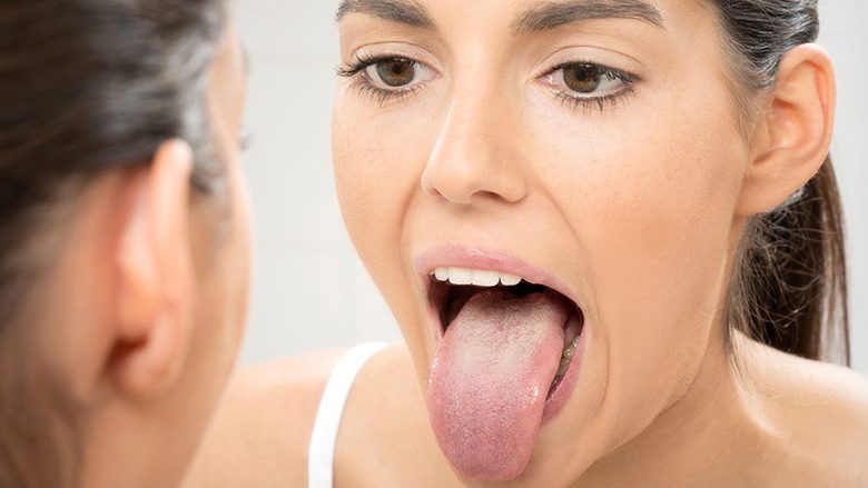 Testi 15-minutësh që ju ndihmon të dalloni nëse keni myk në gojë
