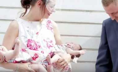 Historia e rrallë e binjakëve ‘një në një milion’; Si e shpjegojnë mjekët rastin që njëra vajzë lindi me sindromën Down
