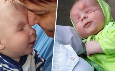 ​Vogëlushi lindi pa sy, birësohet foshnja që u braktis nga prindërit