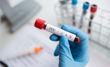 HIV: Simptomat, transmetimi, mbrojtja dhe trajtimi