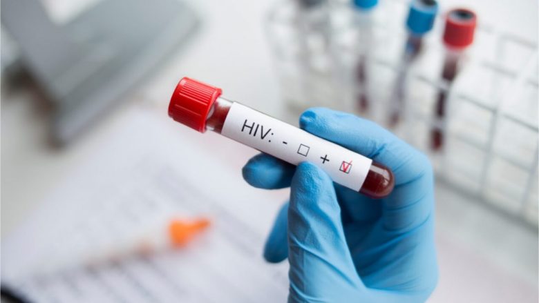 HIV: Simptomat, transmetimi, mbrojtja dhe trajtimi