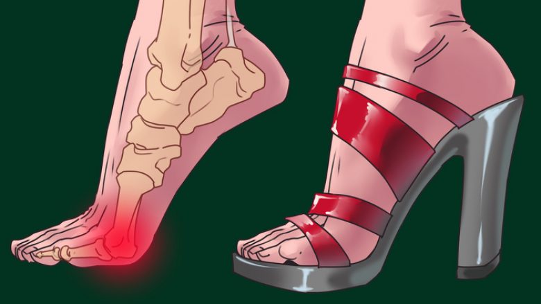 Takat e larta jo vetëm që dëmtojnë këmbët tuaja, por edhe tre pjesë të tjera të trupit