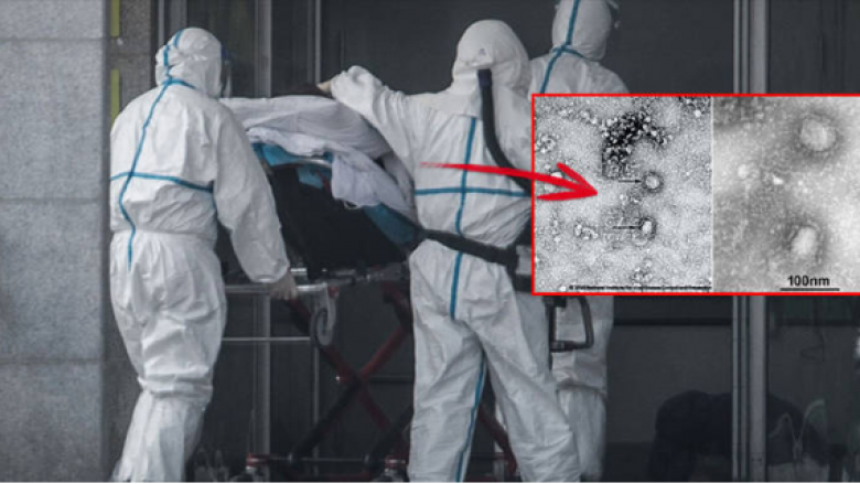 Rasti i parë i dyshuar me infeksion me virusin vdekjeprurës paraqitet edhe në Austri