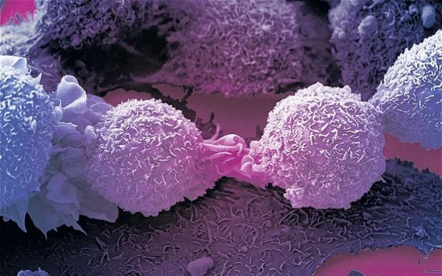 Një lajm i mirë nga shëndetësia: Ka ndodhur një zbulim i ri në sistemin imunitar që “mund të trajtojë të gjitha kanceret”