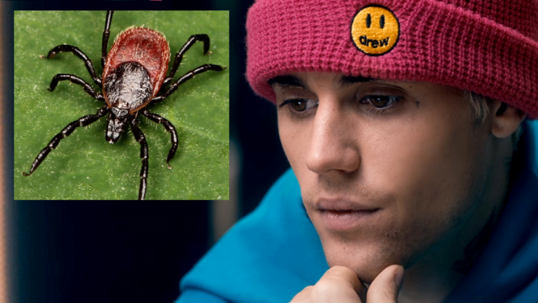 Justin Bieber tregon se po vuan nga sëmundja Lyme