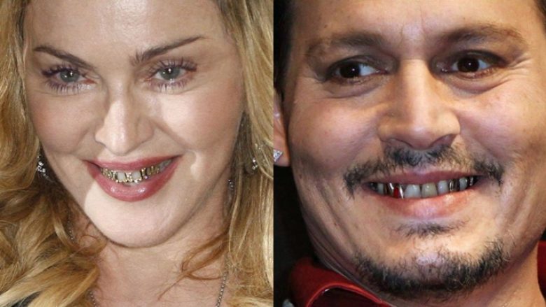Yjet e Hollywood-it që kanë dhëmbë të ‘shëmtuar’