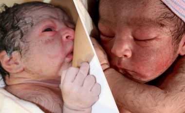 Çifti amerikan sjellin në jetë foshnjën që ka qime në këmbë, shpinë e kokën e mbushur me flokë