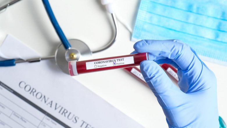 Greqia konfirmon rastin e parë me coronavirus