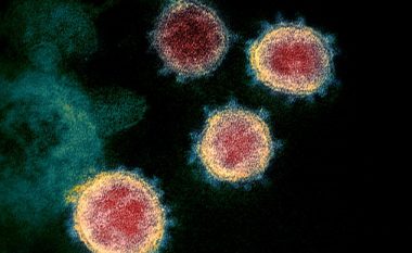 Shkencëtarët amerikanë kanë ‘përfunduar një vaksinë kundër coronavirusit’