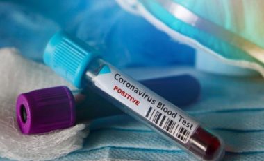 Në Kosovë nuk ka asnjë rast të konfirmuar me coronavirus