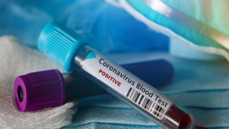 IKSHP konfirmon: Dy pacientet e kthyera nga Italia nuk kanë coronavirus