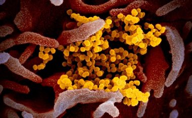 Shfaqen imazhet e para të coronavirusit në mikroskop nga shkencëtarët në SHBA
