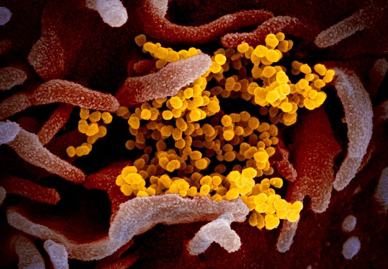Shfaqen imazhet e para të coronavirusit në mikroskop nga shkencëtarët në SHBA