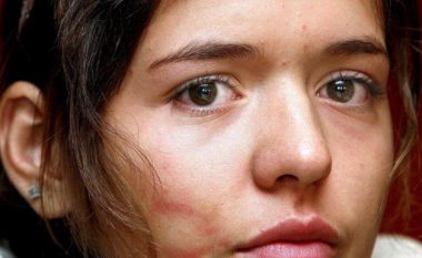 Historia e vajzës kosovare Arigona Zogaj, rasti më unikat i azilit në Austri