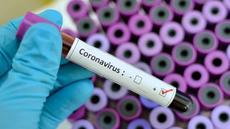 Dyshime për dy pacientë me coronavirus në QKUK, por ata rezultuan negativë, Kosova e paprekur nga ky virus