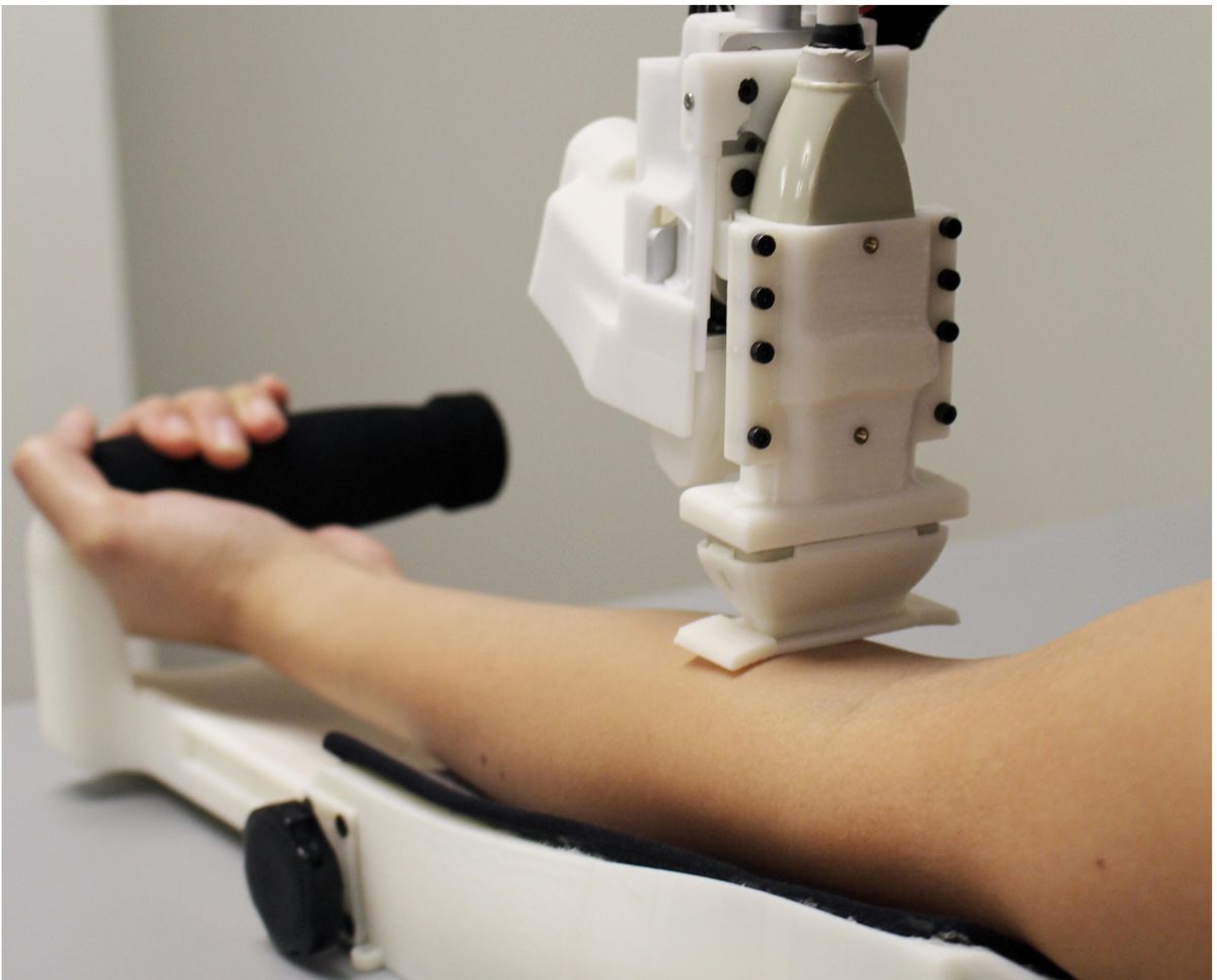 Njihuni me robotin që merr gjakun me më shumë efektivitet se punëtorët mjekësor