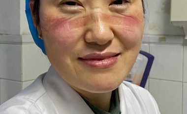 Humanizmi ka fytyrë të bukur, imazhe që tregojnë se çfarë u kanë bërë maskat – mjekët kinezë në luftë kundër coronavirusit