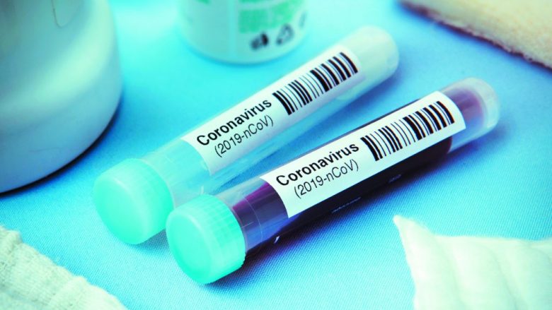 Testime për coronavirus prej sot edhe në Poliklinikat në “Çair” dhe “Mllin Ballkan”