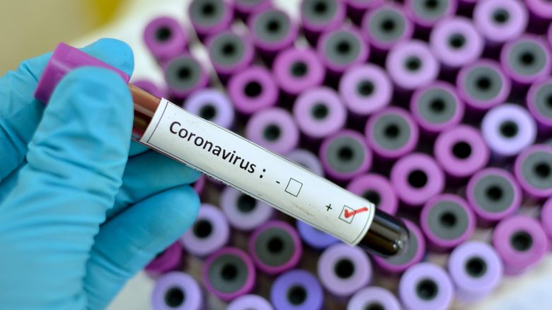 Edhe dy raste të reja të konfirmuara me coronavirus –  shkon në pesë numri i të prekurve në Kosovë