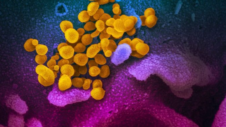 Studimi i ri ka gjetur se coronavirusi mund të mbijetojë jashtë trupit të njeriut deri në nëntë ditë, temperatura e lartë dhe dezinfektuesit mund ta shkatërrojnë virusin
