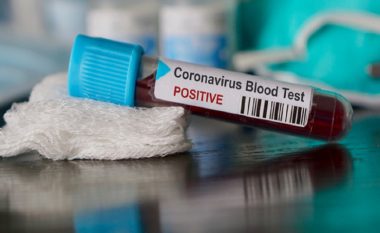 Uellsi konfirmon vdekjen e pacientit të parë nga coronavirusi
