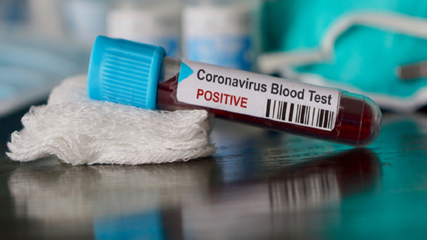 Uellsi konfirmon vdekjen e pacientit të parë nga coronavirusi
