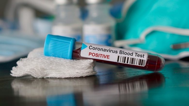 13 raste me coronavirus në Kosovë, Vitia komuna me numrin më të madh të personave të prekur