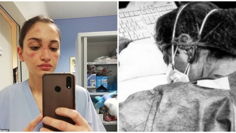 Infermieret italiane rrëfejnë përvojën në luftën kundër coronavirusit, njëra me mavijosje për shkak të maskës – tjetrën e zë gjumi në tavolinë