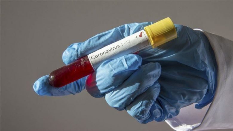 Dy raste të reja me coronavirus në Kosovë, shkon në 90 numri i të infektuarve