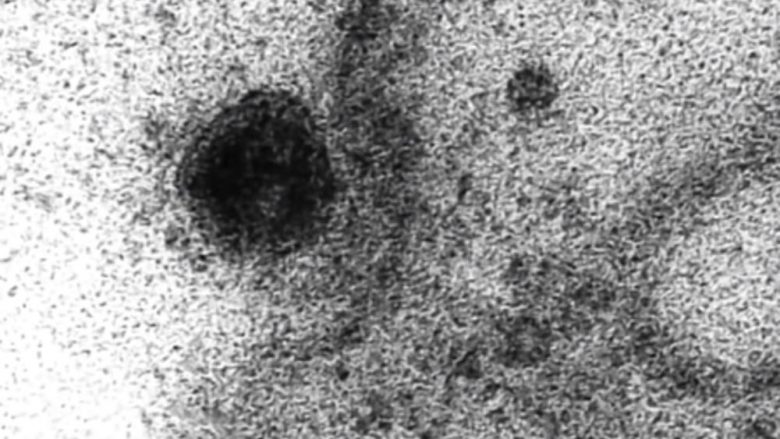 Filmohet coronavirusi duke u futur në një qelizë të njeriut të cilën më pas e infekton, pamjet janë publikuar nga hulumtuesit brazilianë