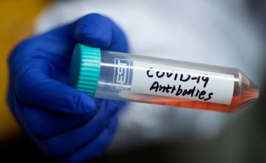 Testi i ri i antitrupave për coronavirus me ’99 për qind saktësi’ është aprovuar për përdorim