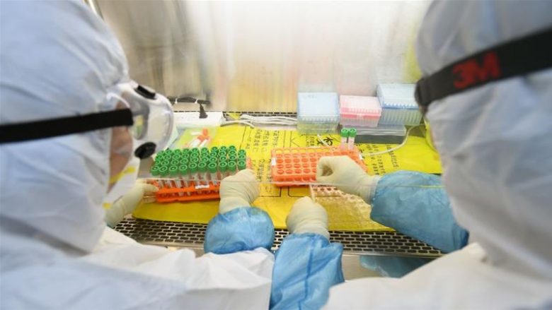 Origjina e coronavirusit: Shumë teori, disa më të besueshme se të tjerat – ka që thonë se nuk duhet përjashtuar as “aksidenti laboratorik”