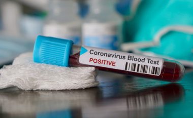 Rreth 2.000 raste me coronavirus në Shkup, më së shumti Komuna e Çairit