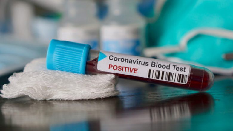 50 të shëruar dhe 22 raste të reja me coronavirus në Maqedoni