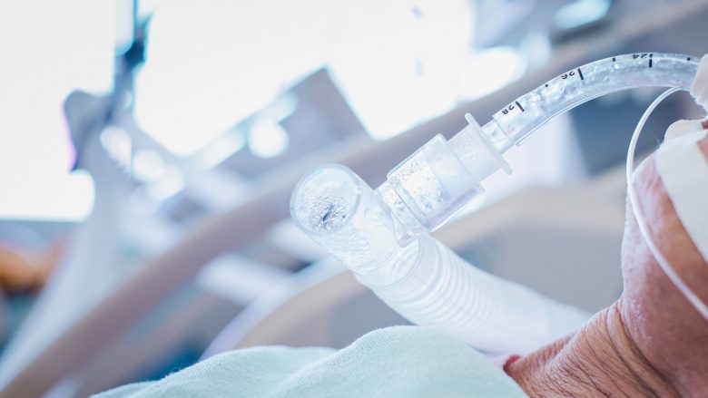 Rreth 80 për qind e pacientëve me ventilator në New York po vdesin, disa mjekë po përpiqen të ndalojnë përdorimin e tyre