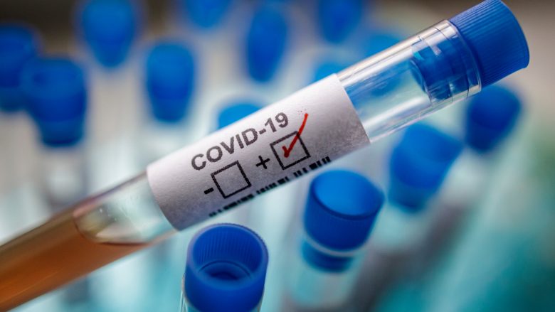 ​Gjendja me COVID-19 në Mitrovicë, 14 infektuar në vetizolim dhe një në Infektiv